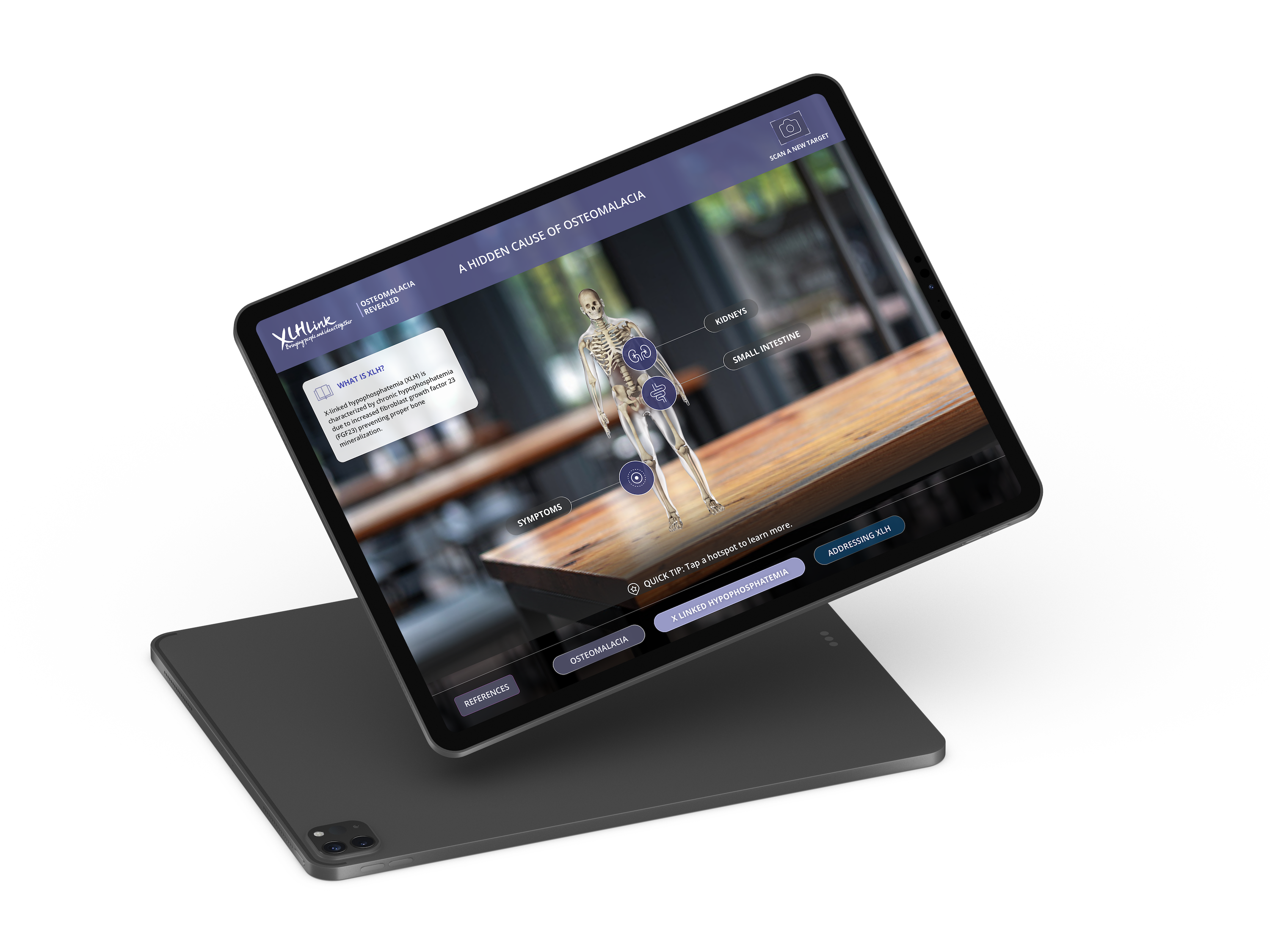 iPad with a skeleton that has kidneys, small intestines, and symptom labels