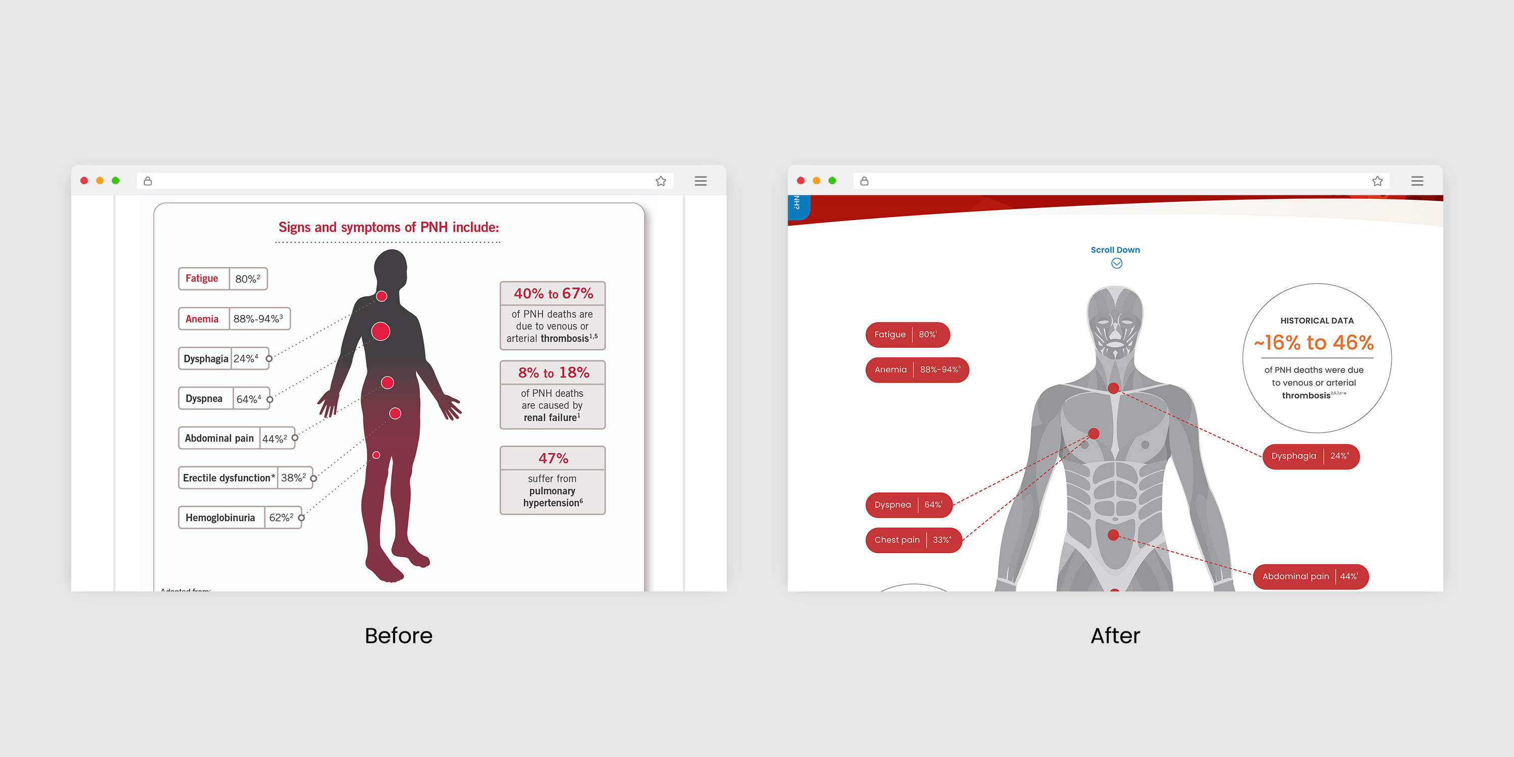 Before and after screens of human illustration labeling symptoms of PNH