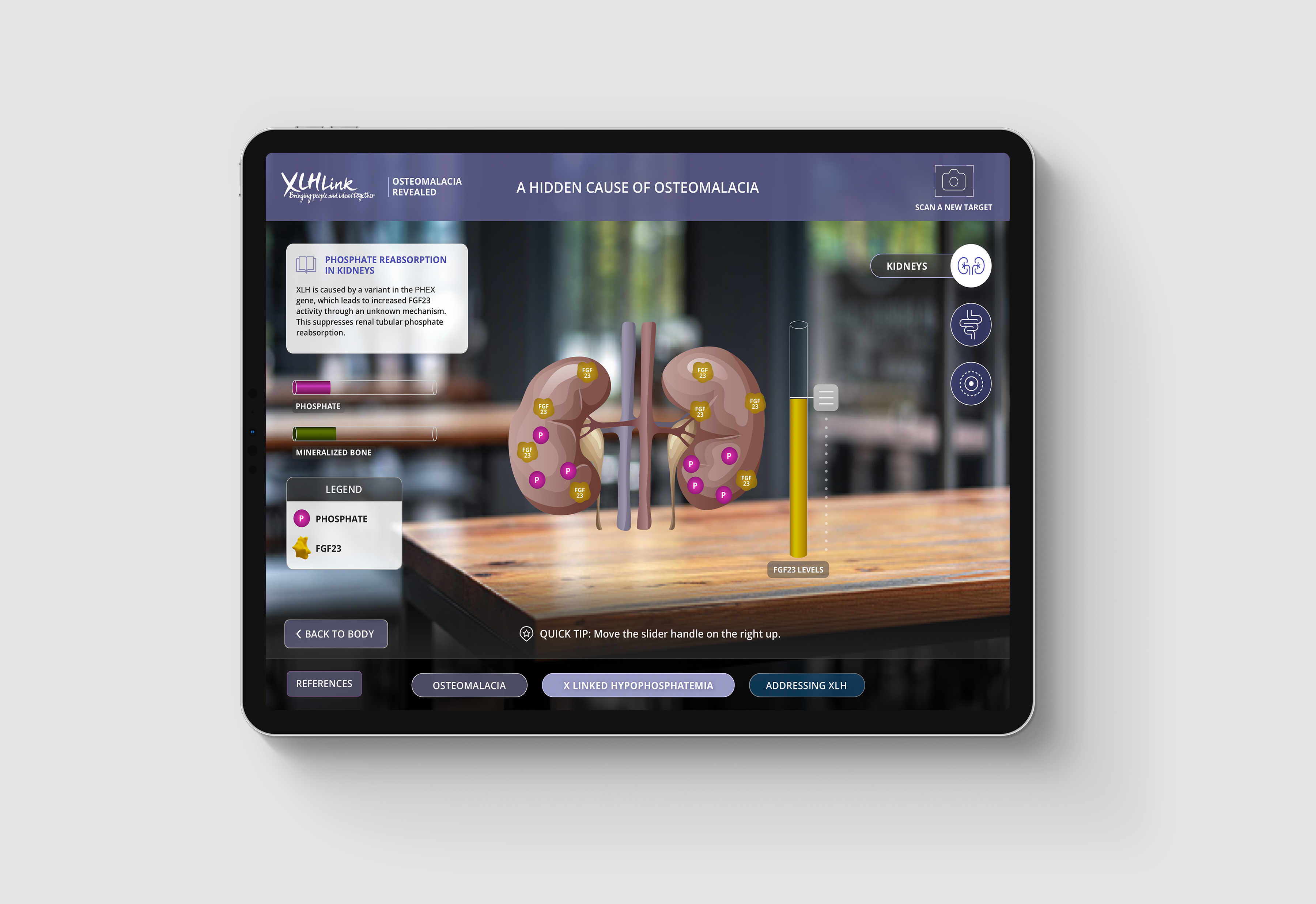 an iPad screen with kidneys and a vertical slider