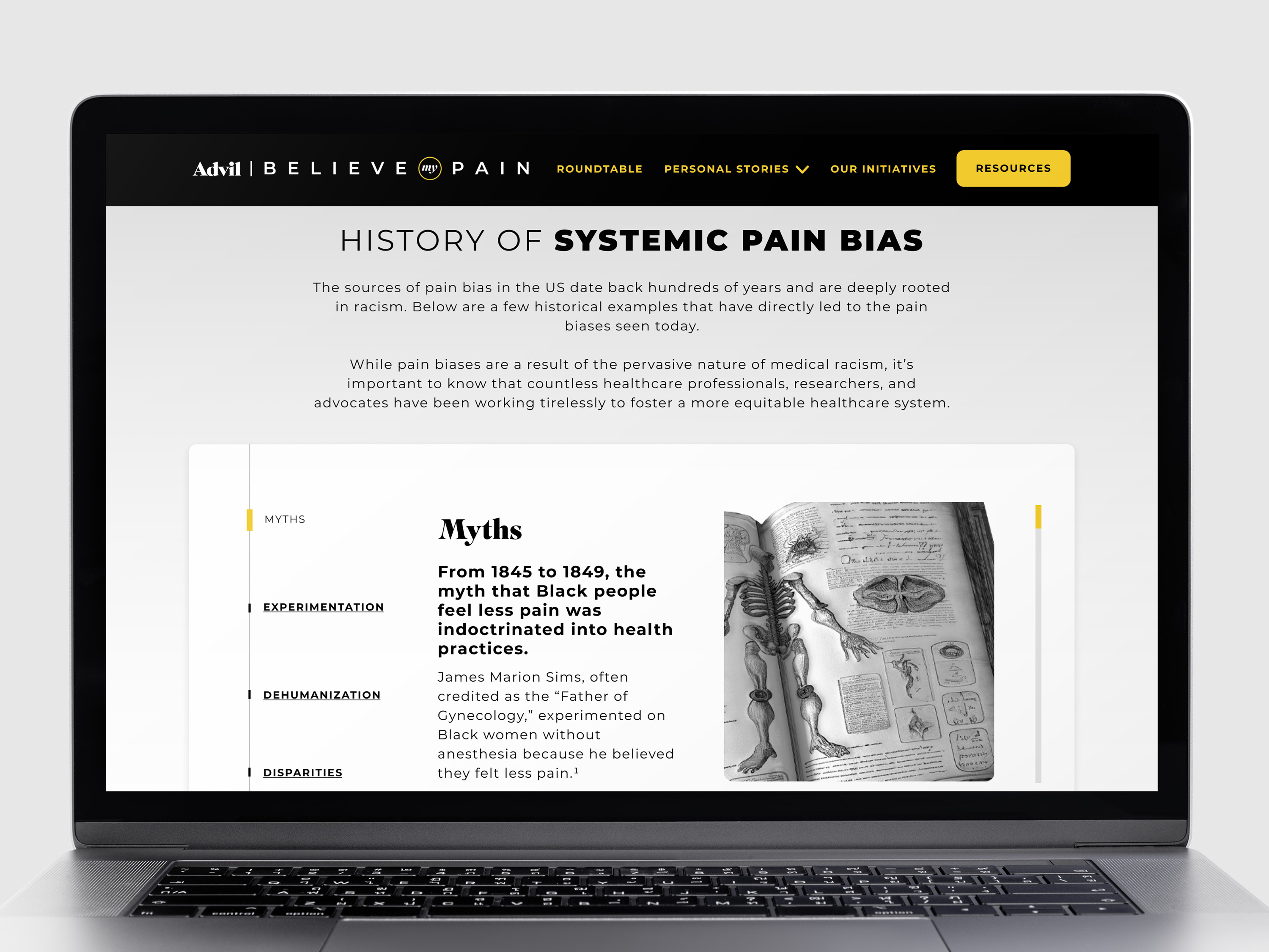 a website screen for Believe My Pain with the History Timeline